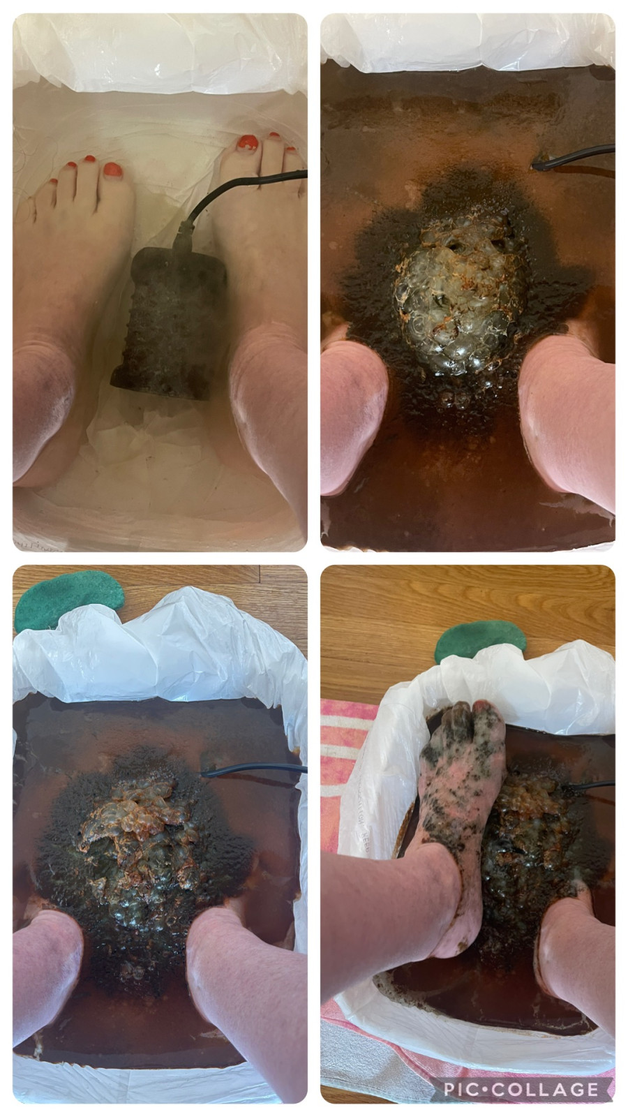 My Journey Detoxing from Heavy Metals: Symptoms, Sources, and Solutions