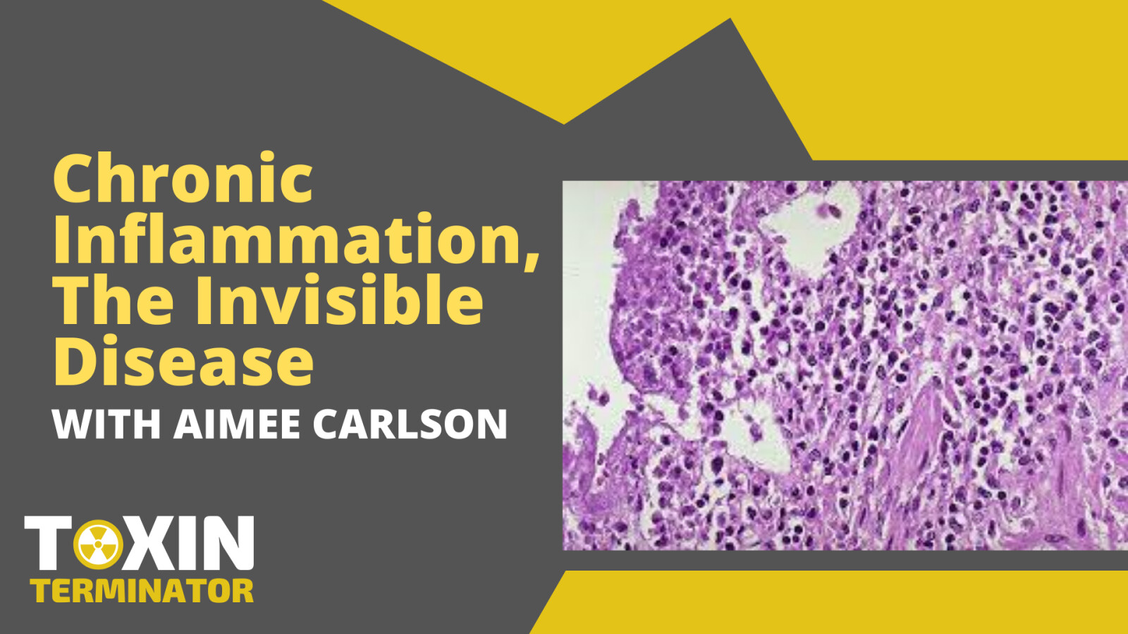 Chronic Inflammation, The Invisible Disease
