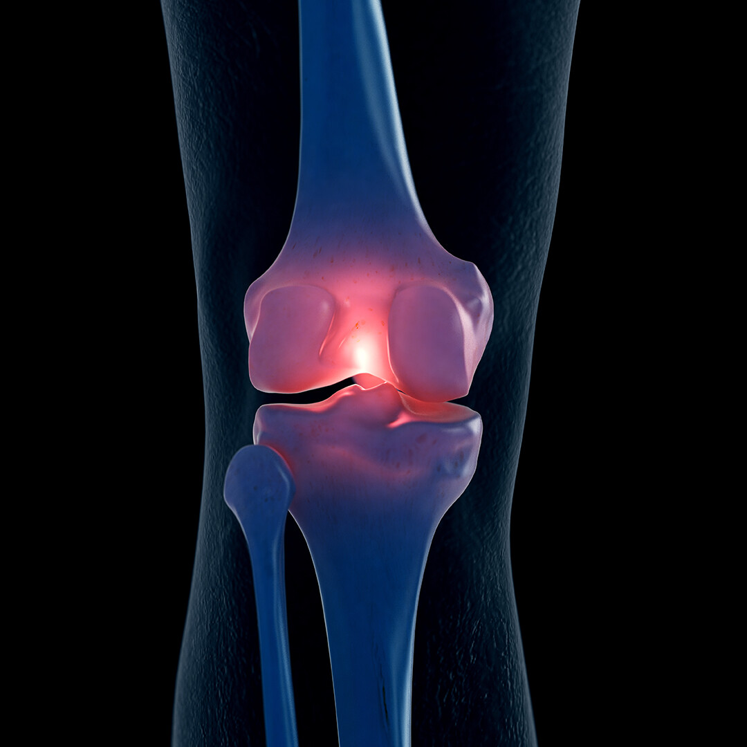 What is the most painful type of arthritis?