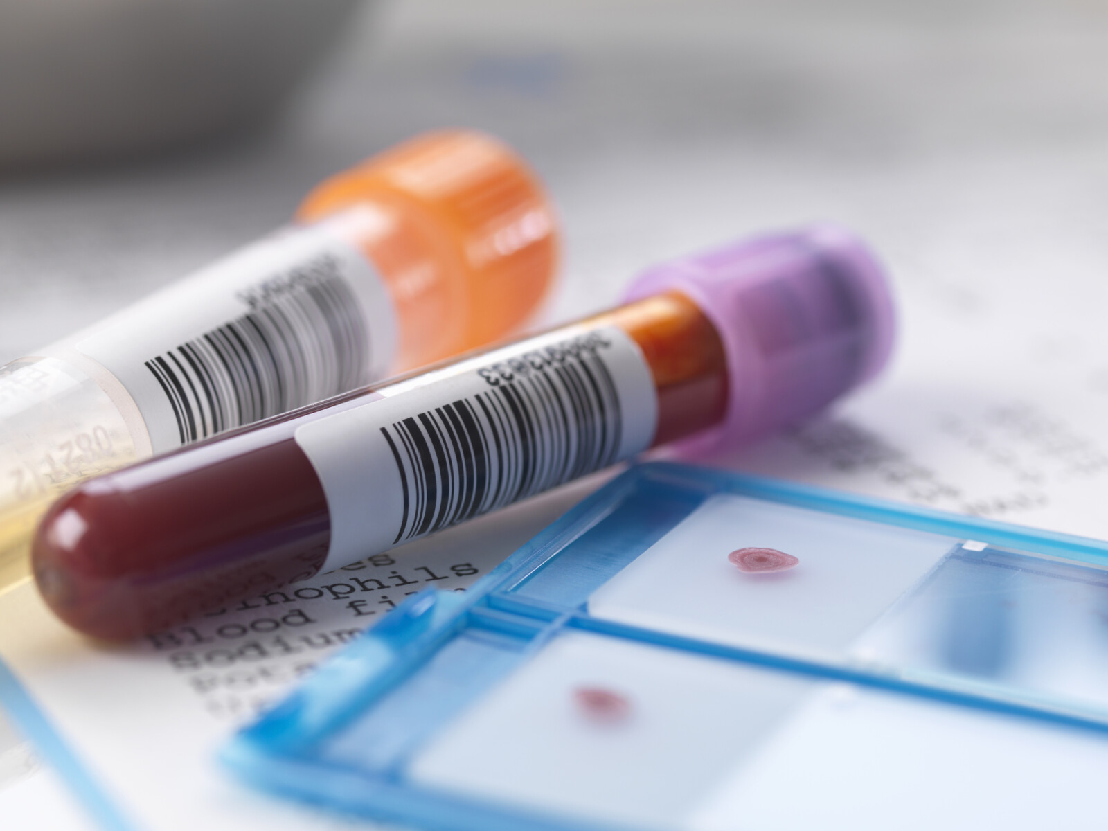 What blood test shows arthritis?