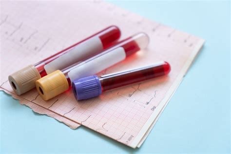 What Your Doctor Doesn’t Tell You: What Your Blood Tests Aren’t Showing You