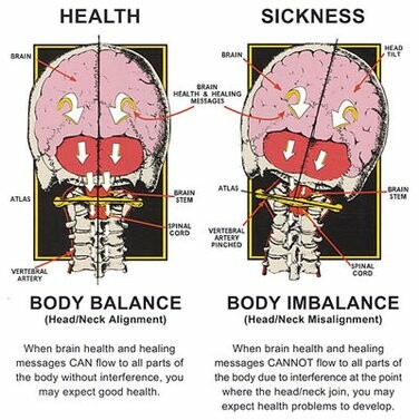 How I Chose My Chiropractor as an HSP With TMJD