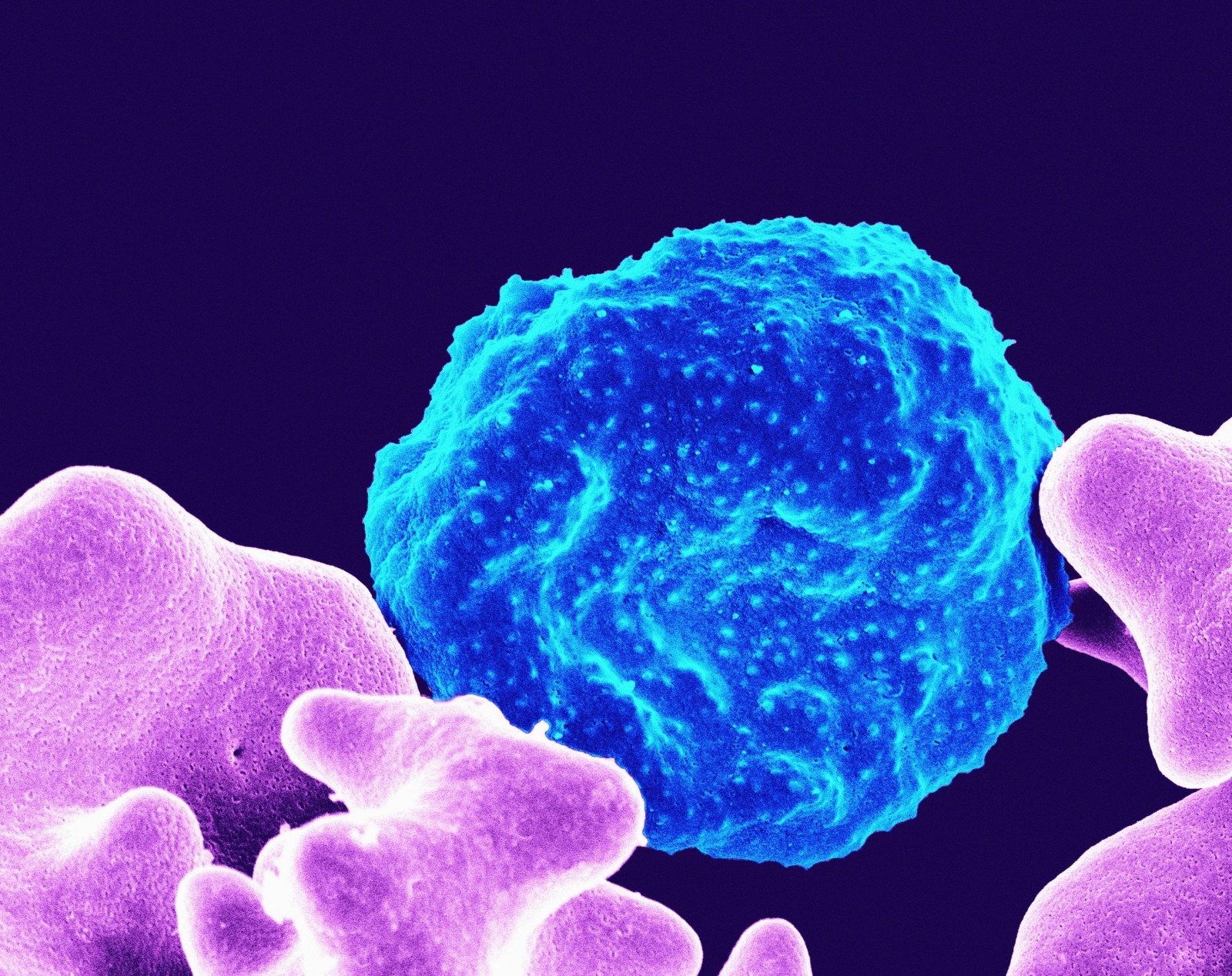 Parasites: The Missing Piece to Stubborn Fatigue