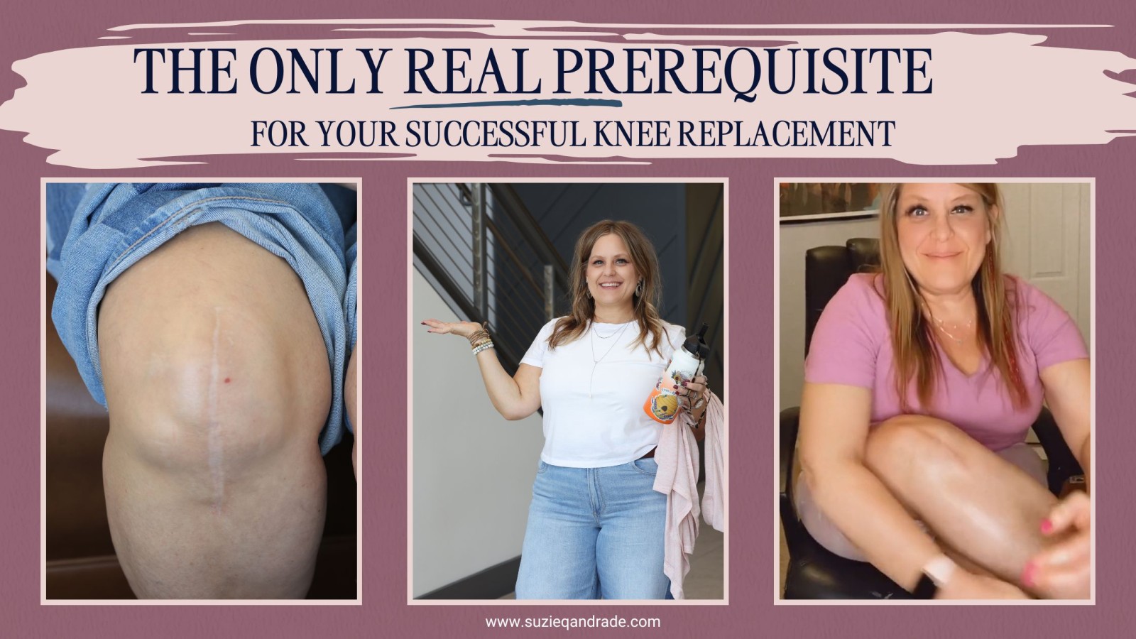 The Only Real Prerequisite for a Successful Knee Replacement