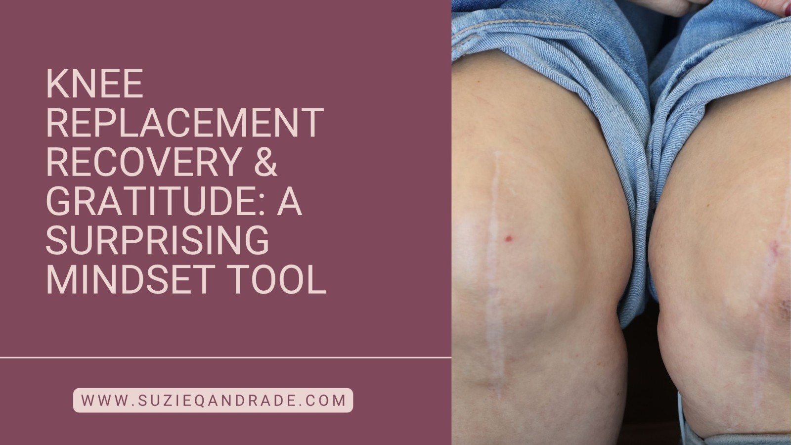 Knee Replacement Recovery & Gratitude: A Surprising Mindset Tool