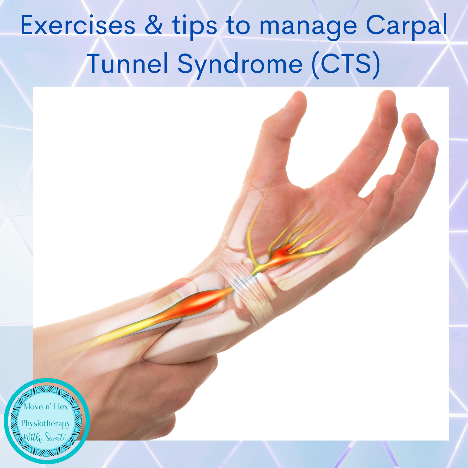 Easy exercises to manage Carpal Tunnel Syndrome and some useful tips to manage it