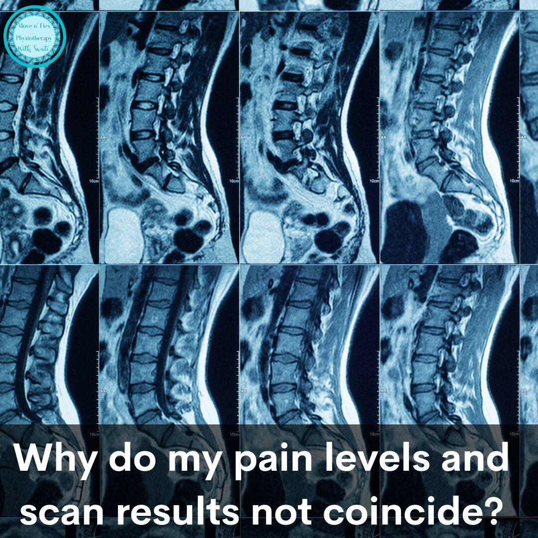 Why do my pain levels and my scan results not coincide?