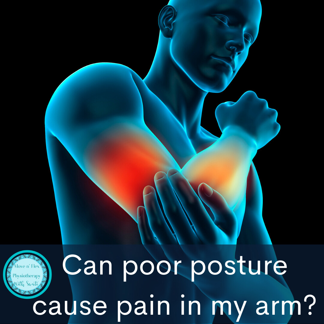 Can poor posture cause pain in the arm?