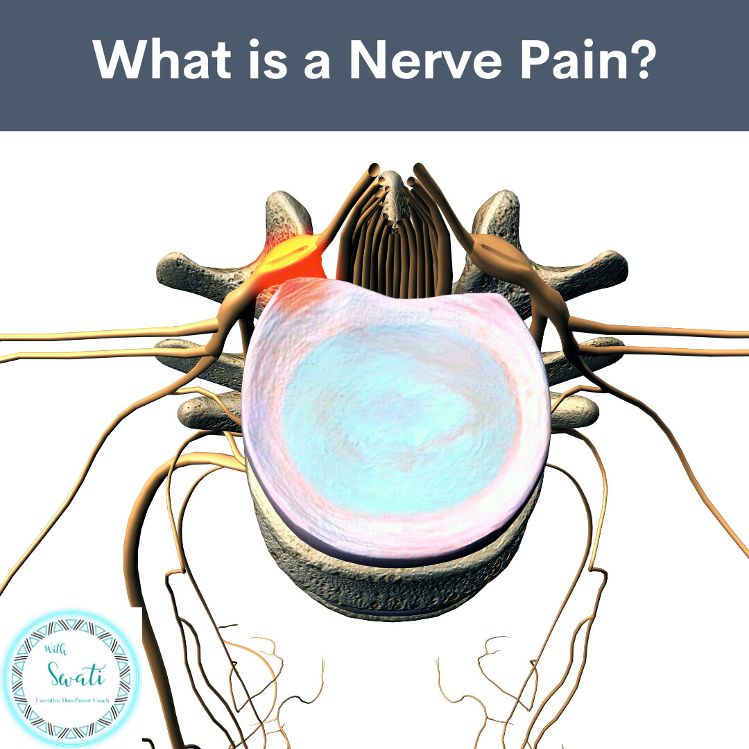 What is a Nerve Pain?