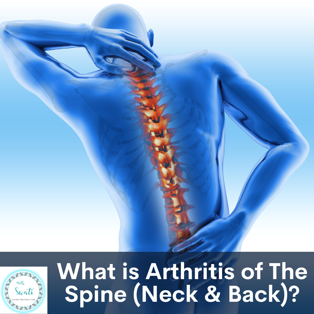 What is Arthritis of the Spine (Neck and Back)?