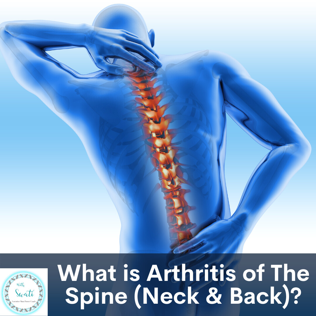 Arthritis In Back And Running at Sheryl Booker blog