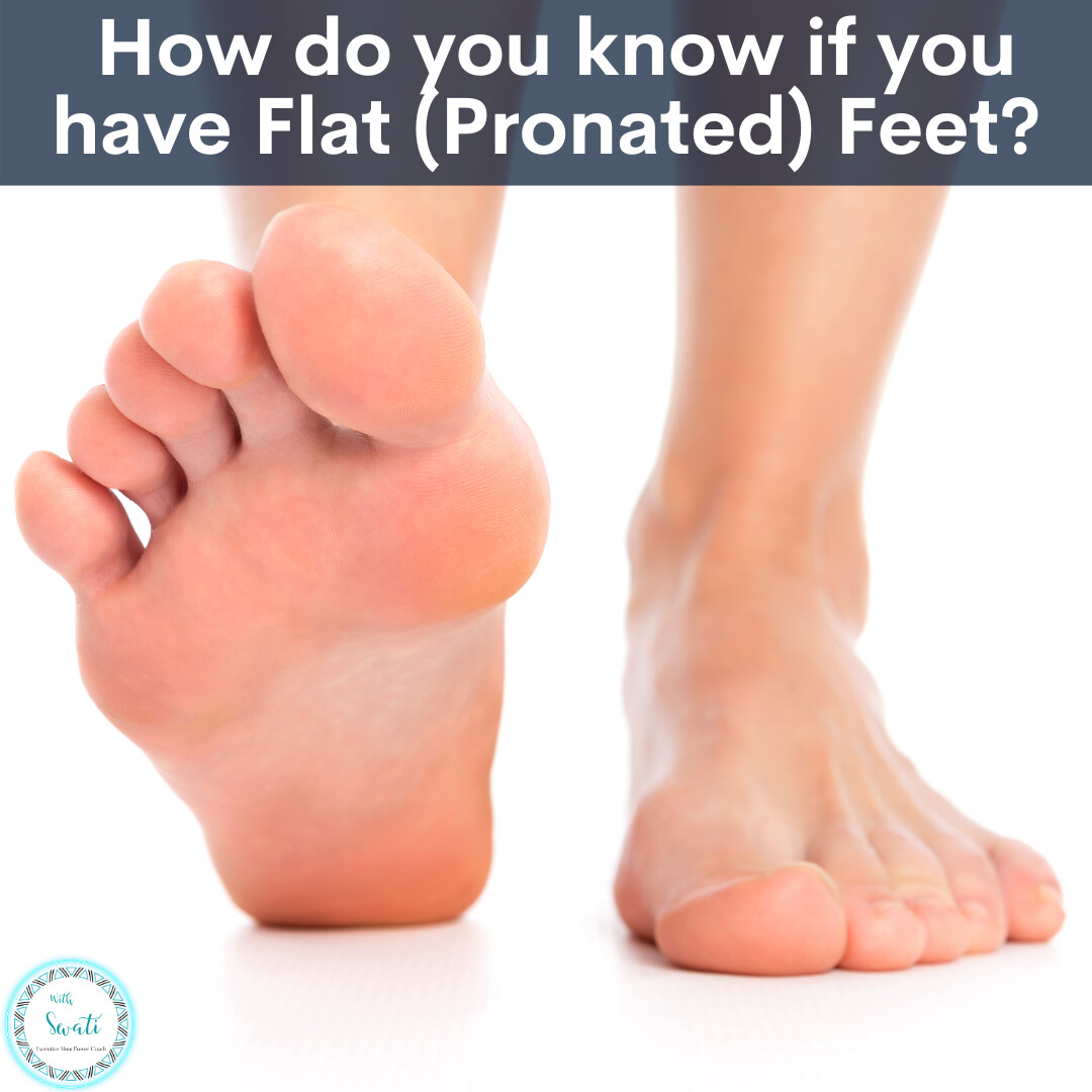 How do you know if you have Flat (Pronated) Feet?