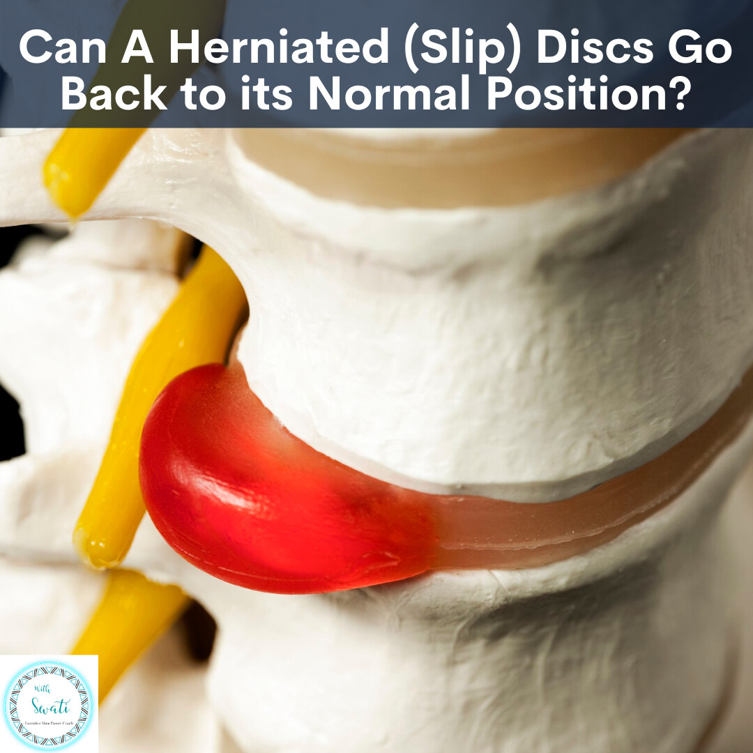 Can a herniated/slip discs go back to its normal position?