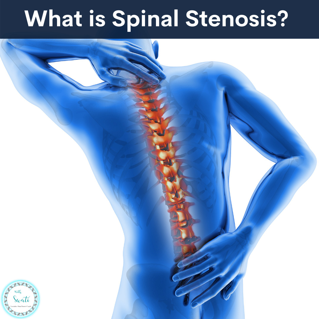What is Spinal Stenosis (Central Spinal Stenosis or Foraminal Stenosis)?