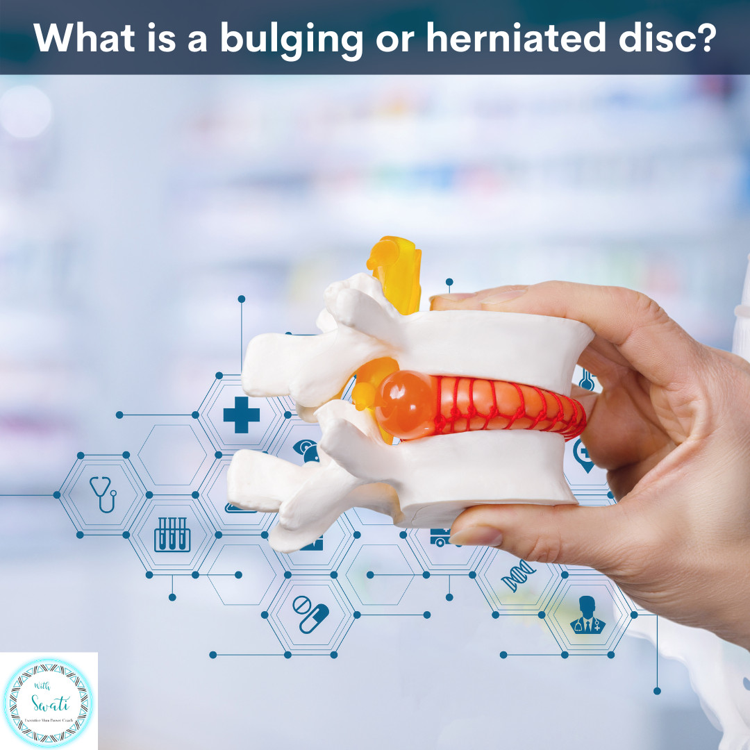 What is a bulging or herniated (slipped) disc? 