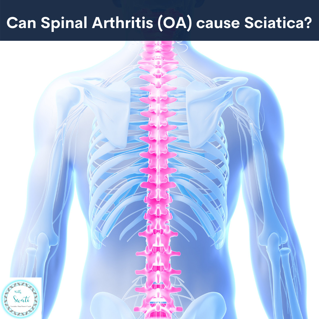 Can Spinal (back & Neck) Arthritis (OA) cause Sciatica?