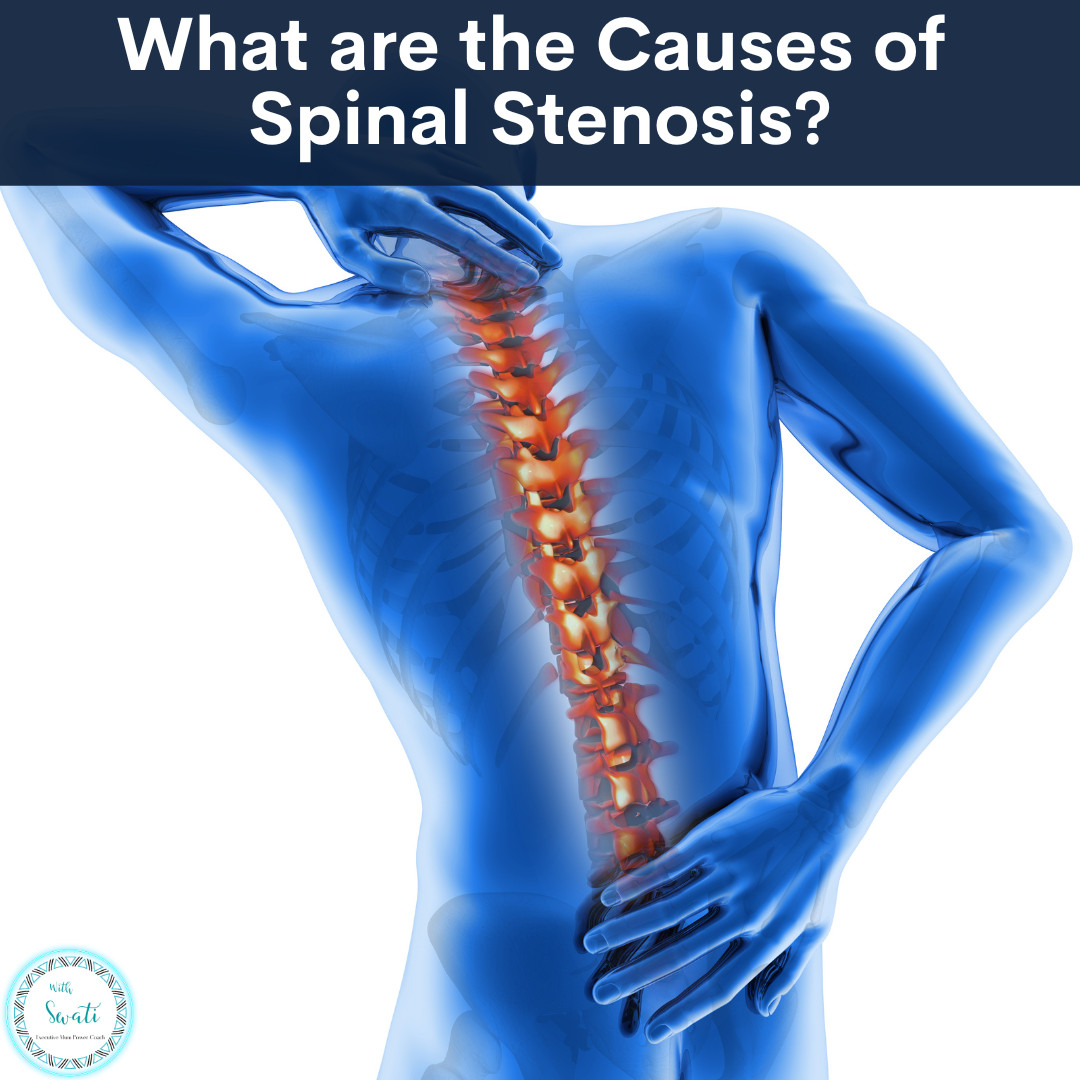 What are the Causes of Spinal Stenosis?