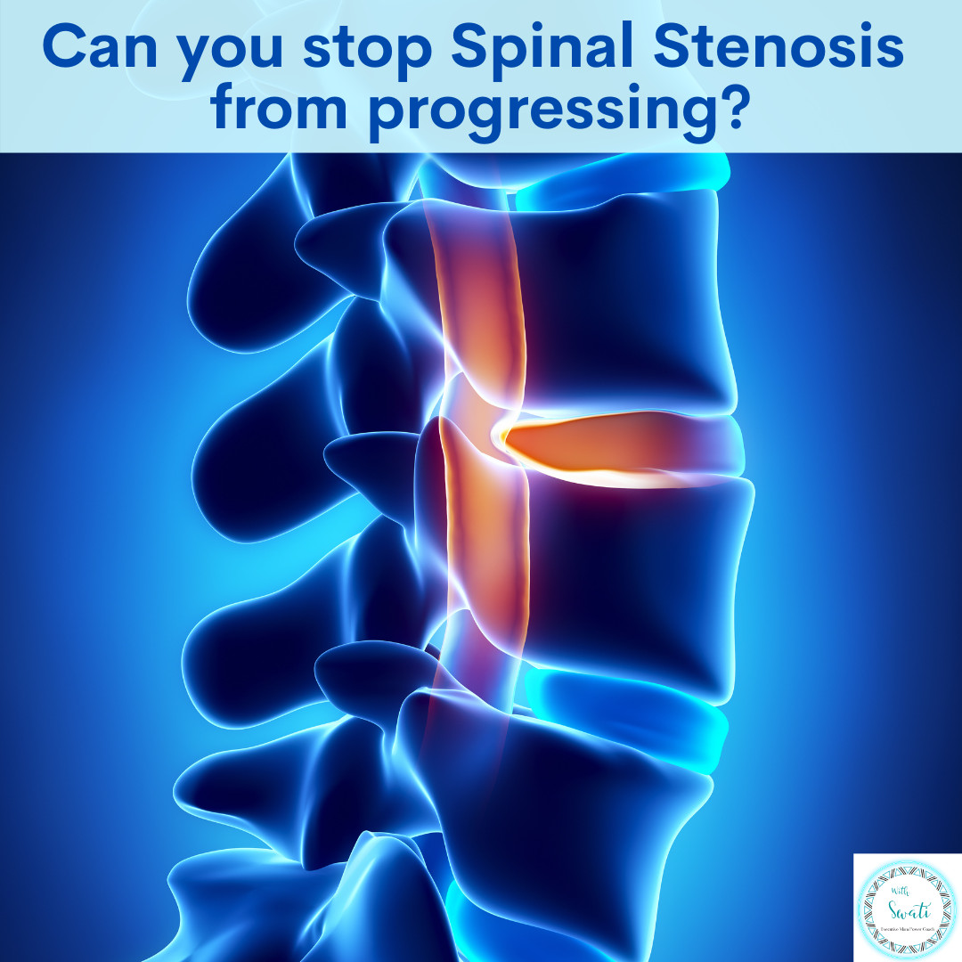 Can you stop Spinal Stenosis from progressing?