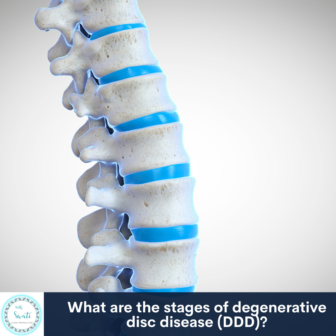 What are the stages of degenerative disc disease (DDD)?