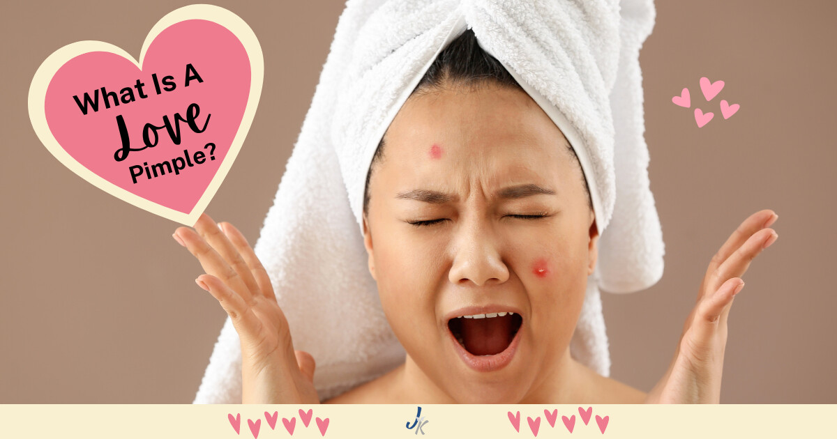 Love Pimples: What They Are and How To Treat Them