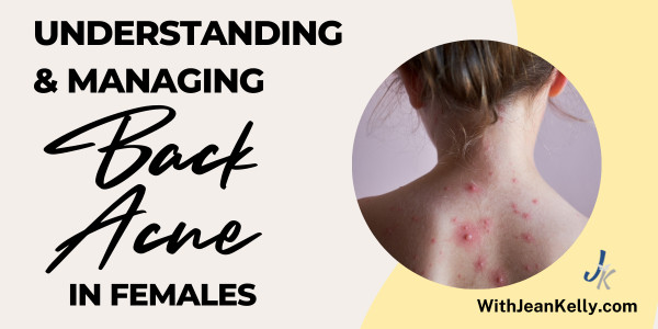 Understanding and Managing Back Acne in Females