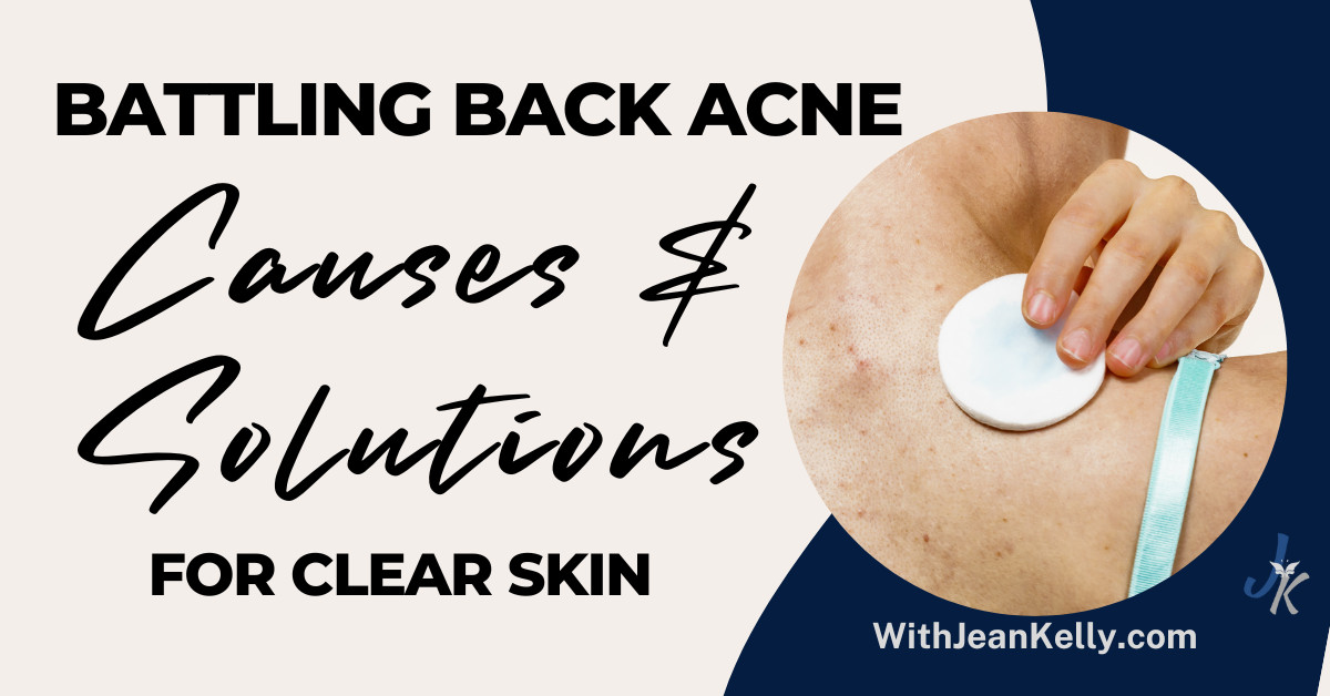 Battling Back Acne: Causes and Solutions for Clear Skin