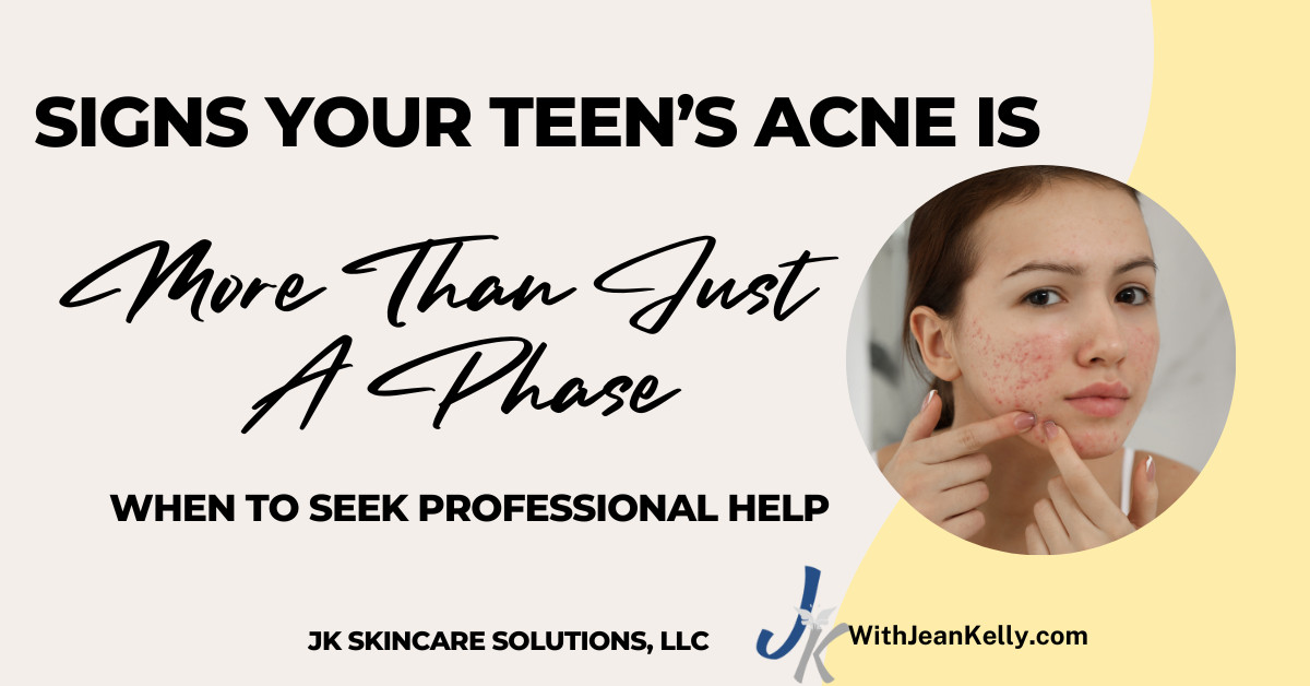 Signs Your Teen’s Acne Is More Than Just a Phase