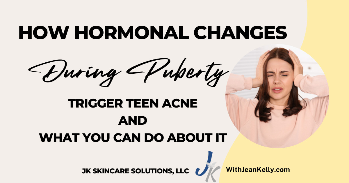 How Hormonal Changes During Puberty Trigger Teen Acne and What You Can Do About It