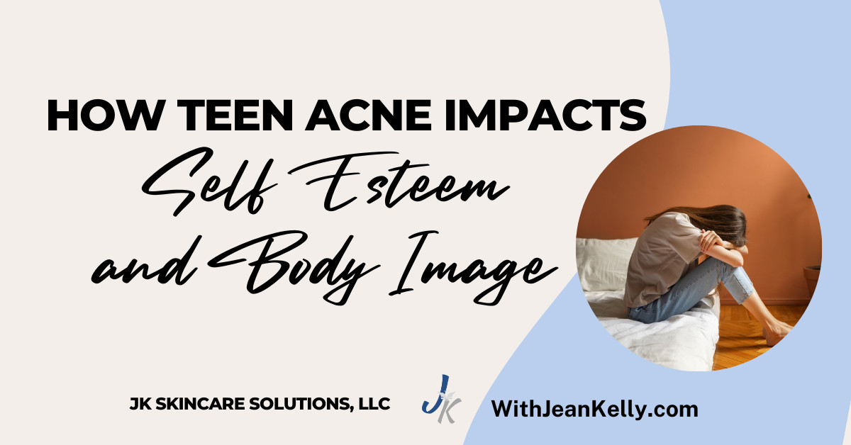 How Teen Acne Impacts Self-Esteem and Body Image