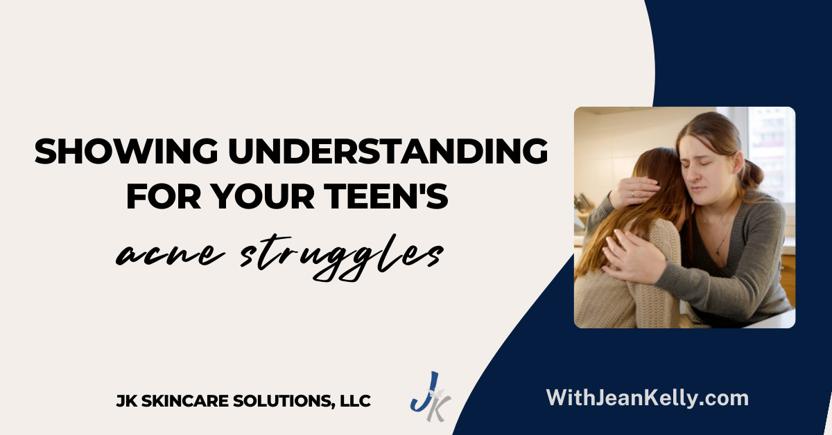 Showing Understanding for Your Teen's Acne Struggles