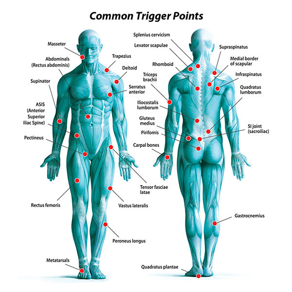 Emotional Triggers and Trigger Points