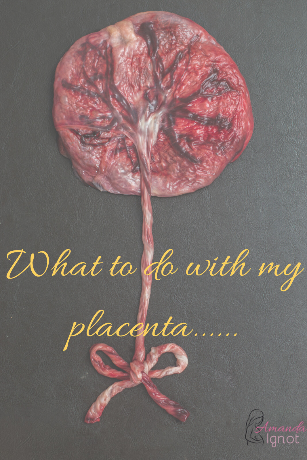 What to do with your placenta…….
