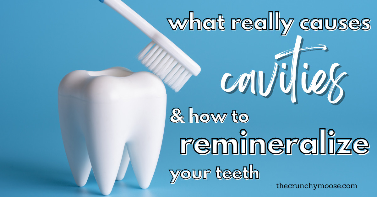 What Really Causes Cavities & How to Remineralize Teeth