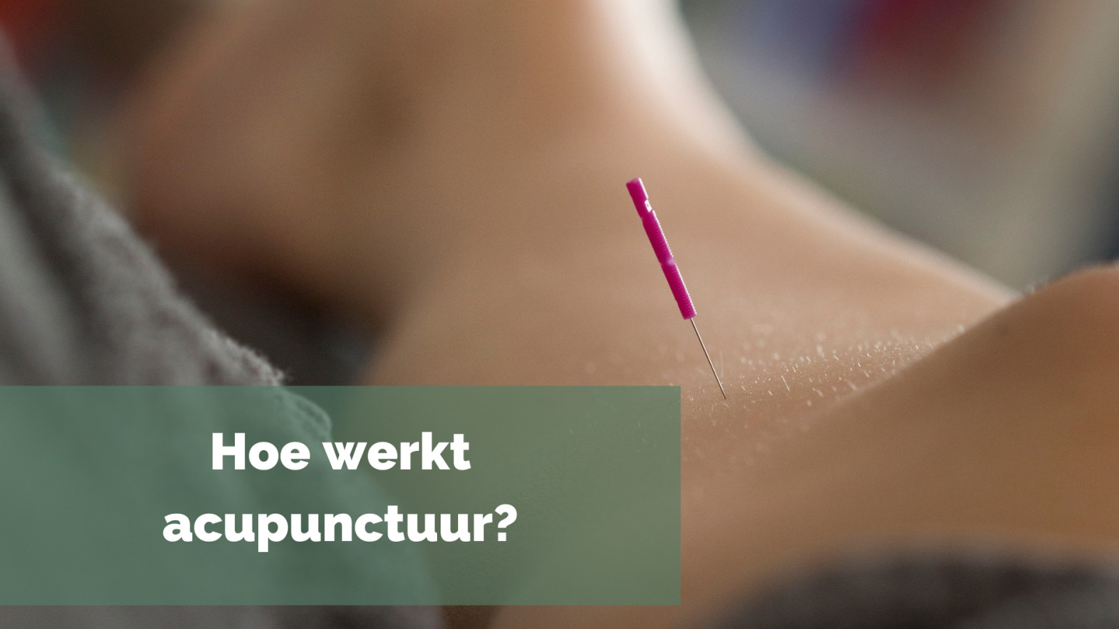 Hoe werkt acupunctuur?