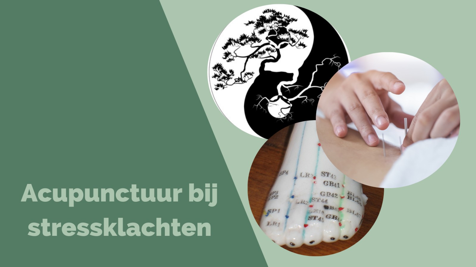 Acupunctuur bij stressklachten