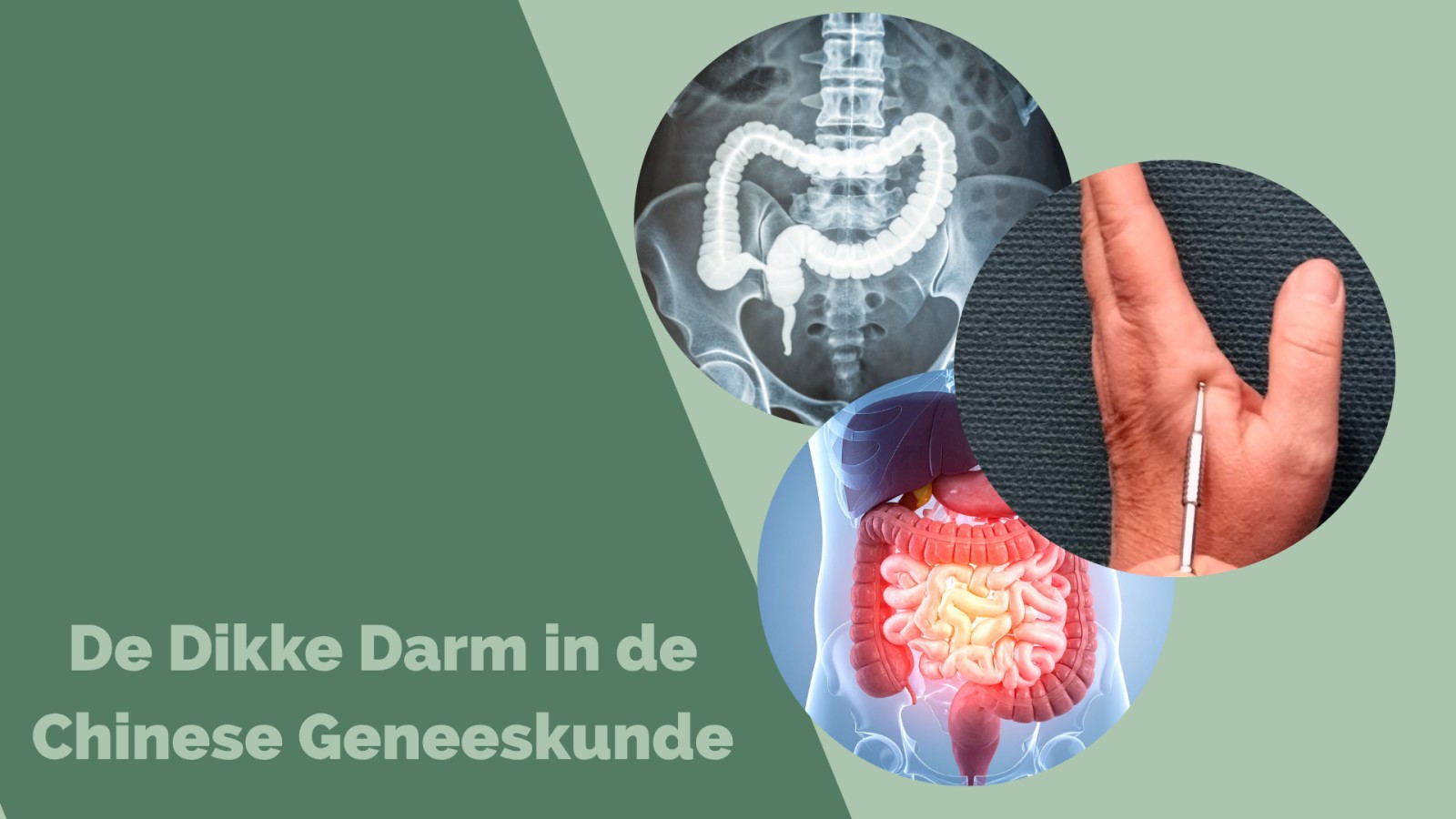 De Dikke Darm in de Chinese Geneeskunde