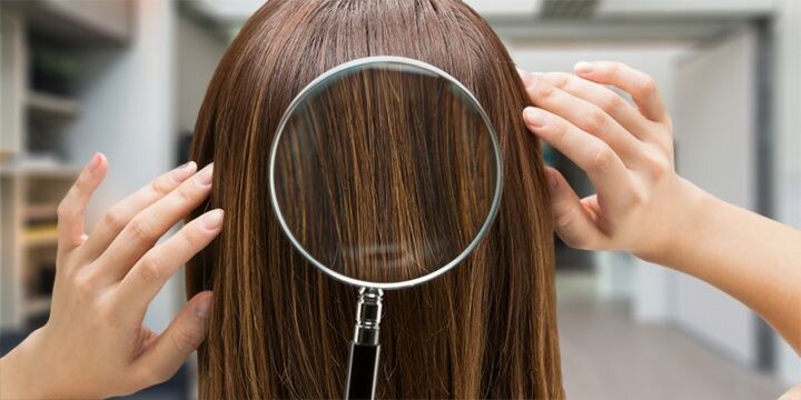 Did You Know Your Hair Can Tell You a Lot About Your Health?