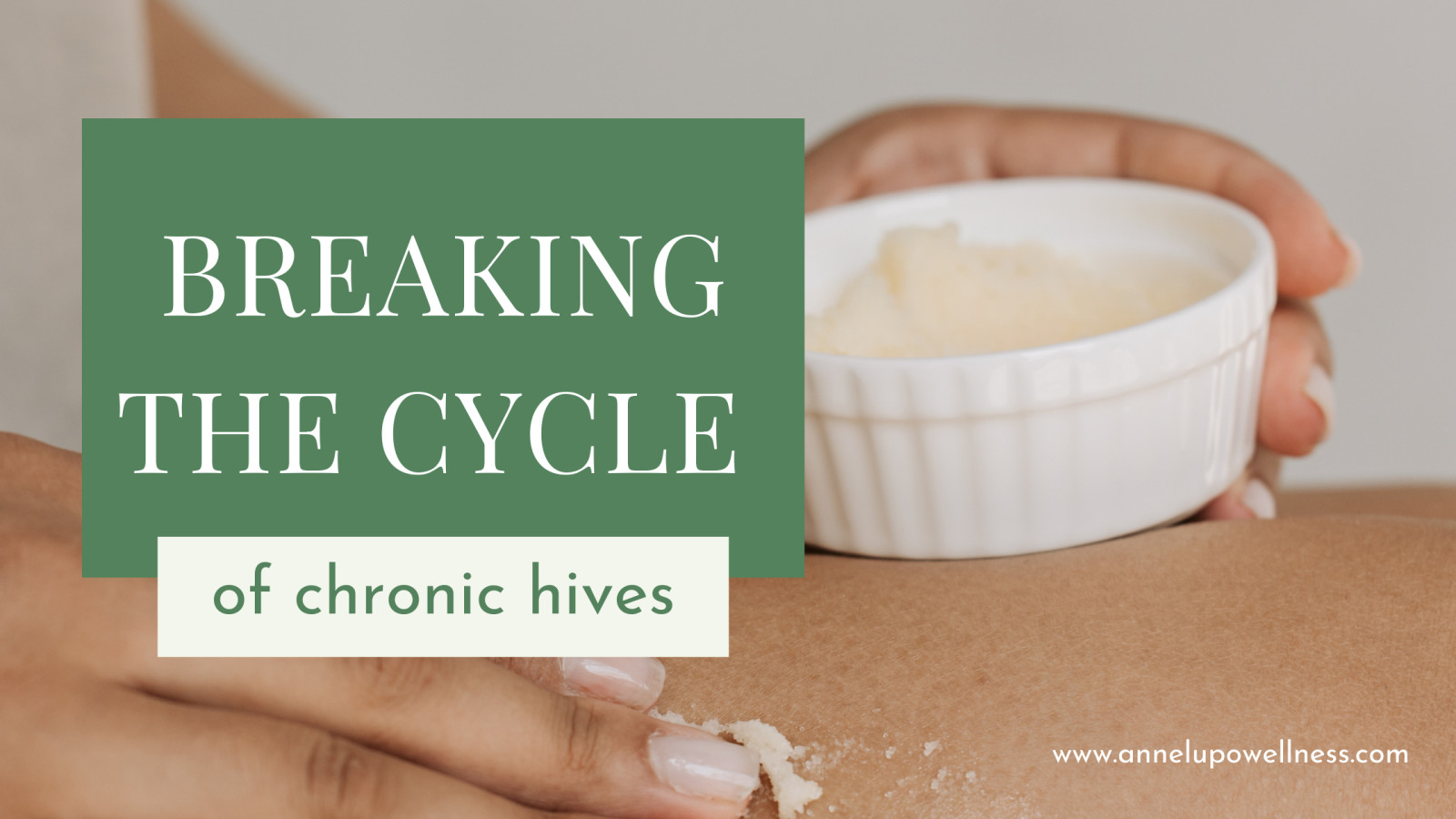 Breaking the Cycle of Chronic Hives: Our Low Histamine Diet Success Story