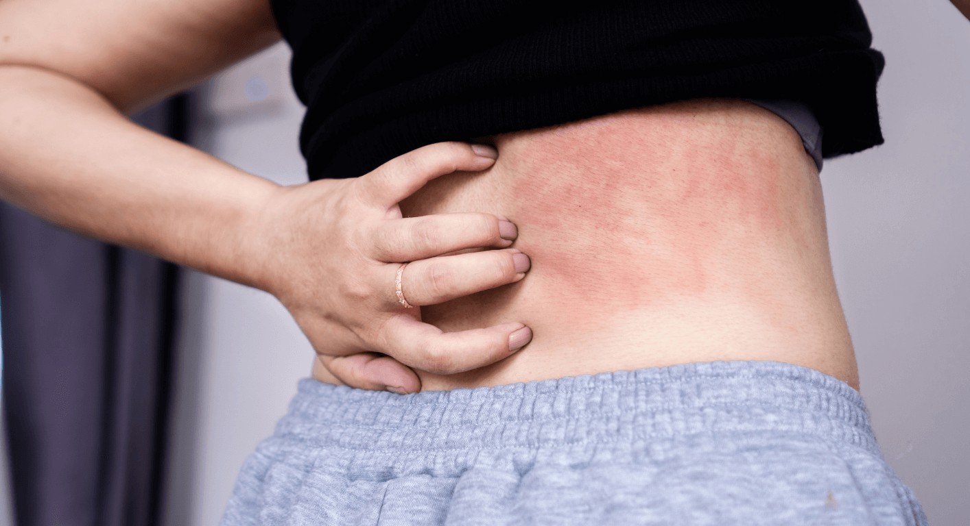 July 2025 - Oil Sensitivities and Allergies Pt #1